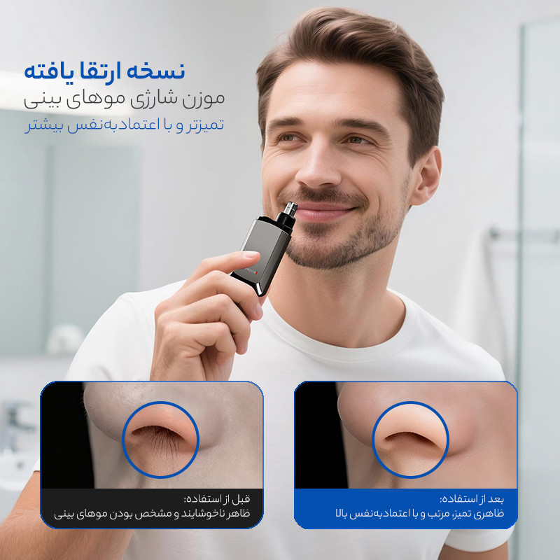 مو زن گوش و بینی کیمنگدون مدل B007